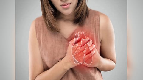 Representative image