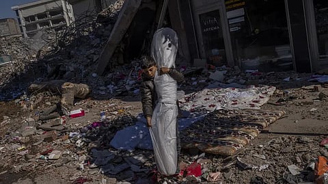 Representative image