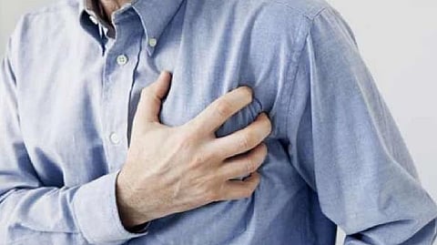 Representative image