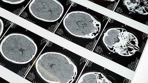 Representative image