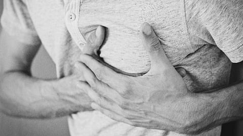 Representative image