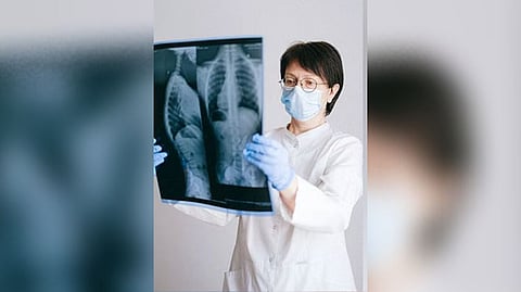 Representative Image