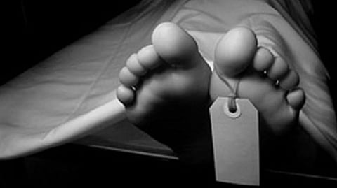 Representative Image