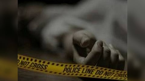 Representative Image