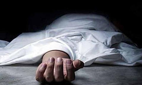 Representative image