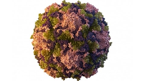 Representative image