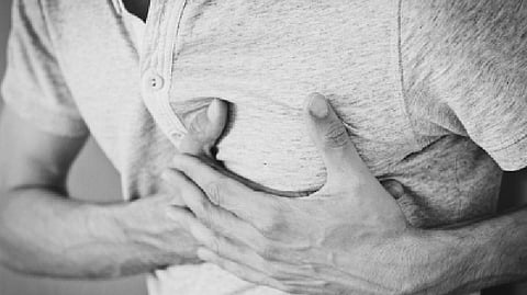 Representative image