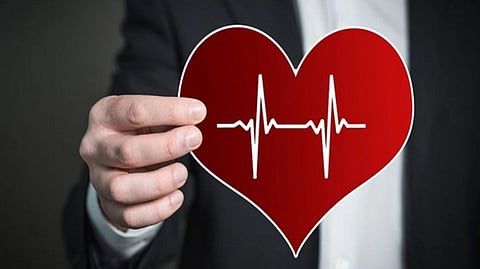 Representative image