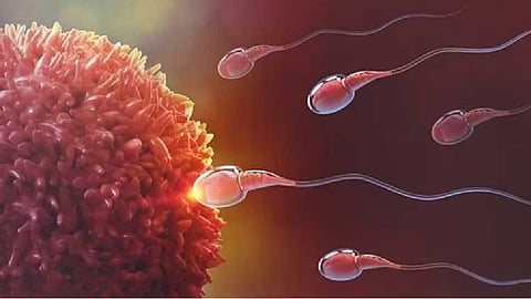 Representative image