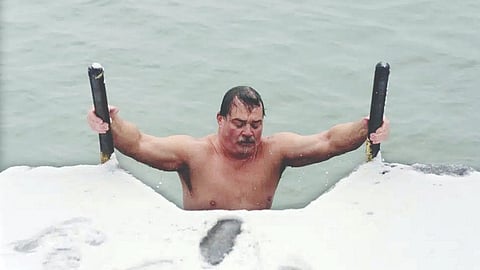 Representative Image