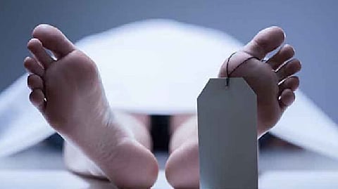 Representative Image