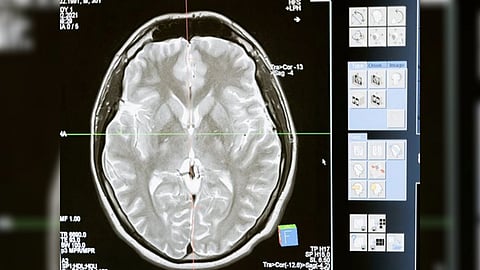 Representative Image