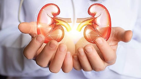 Representative image