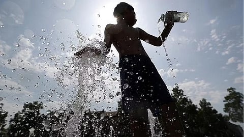 Representative image