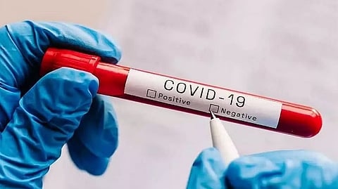 Representative image