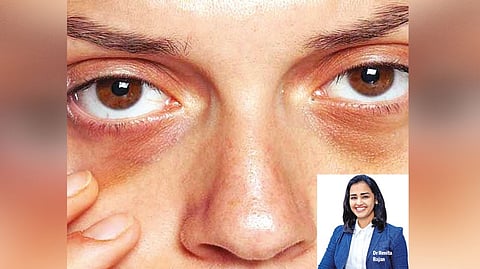 (inset) Dr Renita Rajan