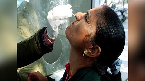 Representative image