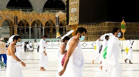 Representative image