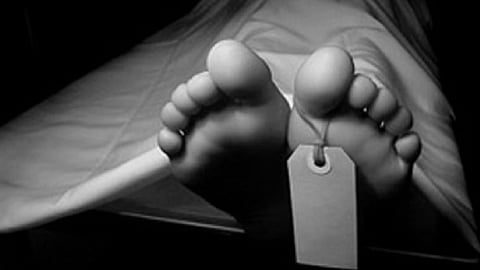 Representative Image