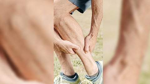 Representative Image