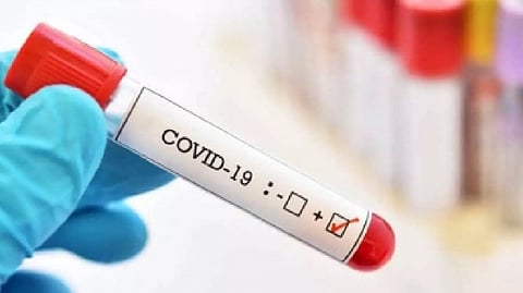 Representative image