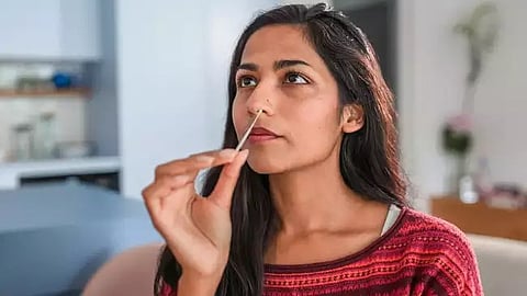 Representative image