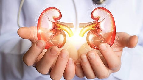 Representative Image