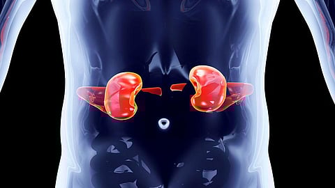 Representative image