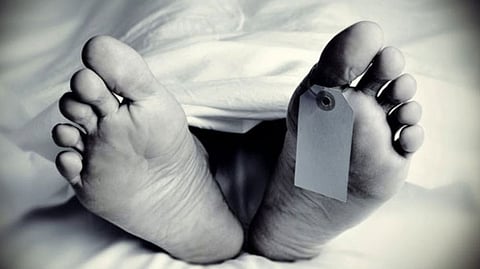 Representative image