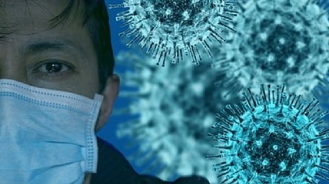 Representative image