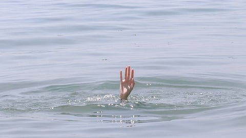 Representative image