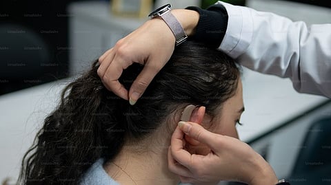 Representative image