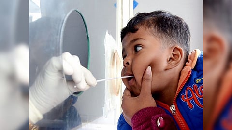 Representative Image