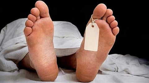 Representative image