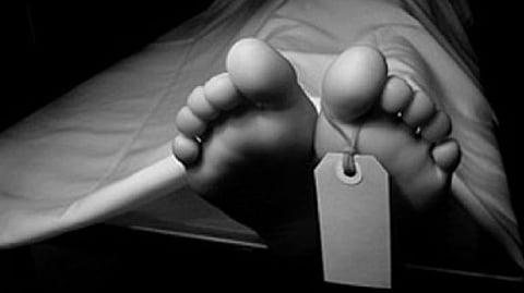 Representative Image