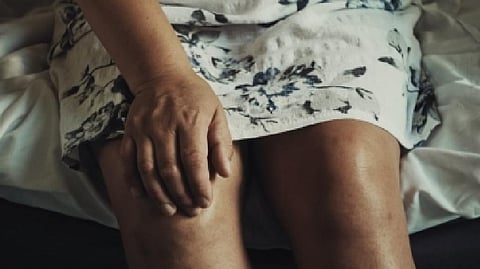 Representative image