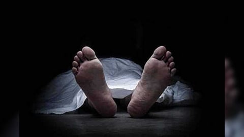 Representative Image