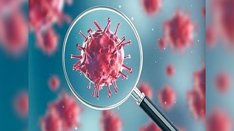 Representative Image