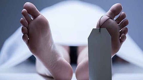 Representative image