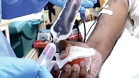 Representative image