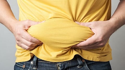 Representative image