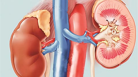 Representative image