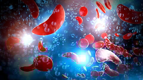 Representative image