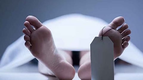 Representative image