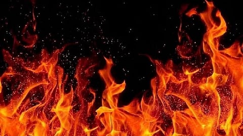 Representative Image