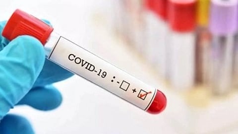 Representative image