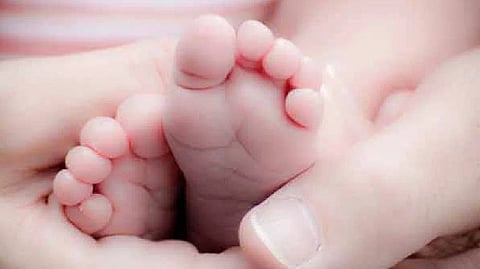 Representative image