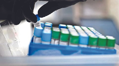 Representative Image