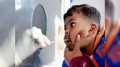 Representative image