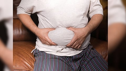 Representative Image